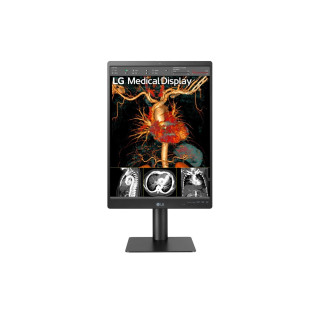 LG 21HQ513D-S écran plat de PC 54,1 cm (21.3") 1536 x 2048 pixels Noir